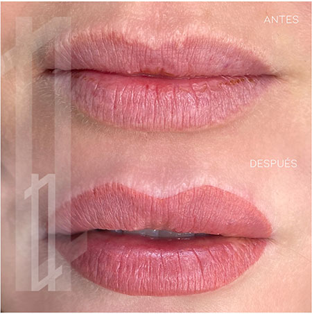 antes y después micropigmentación de labios en Bilbao
