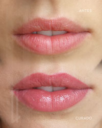 micropigmentación de labios en Bilbao